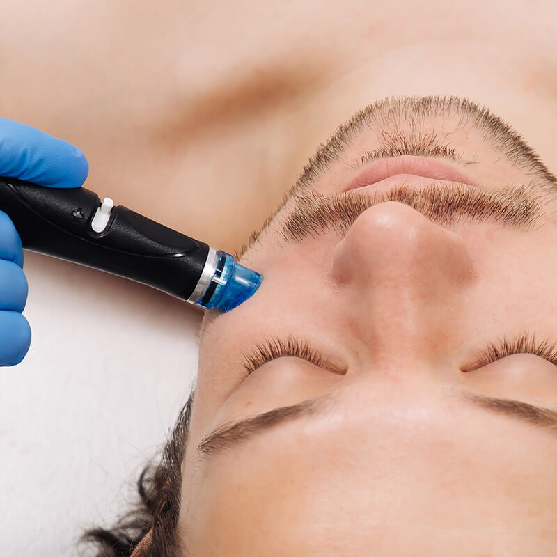 100725-hydrafacial-steps-square