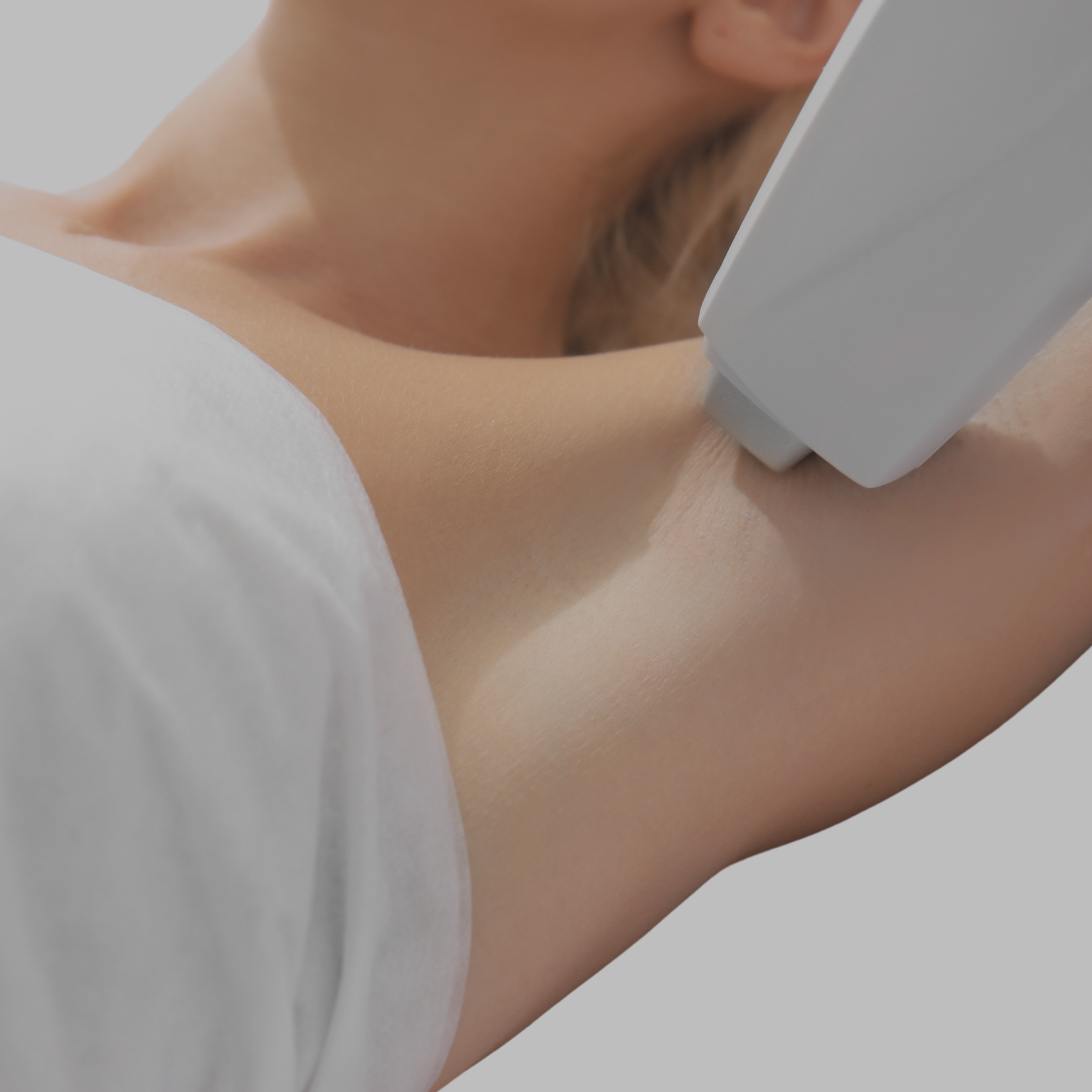 Laser Hair Removal
